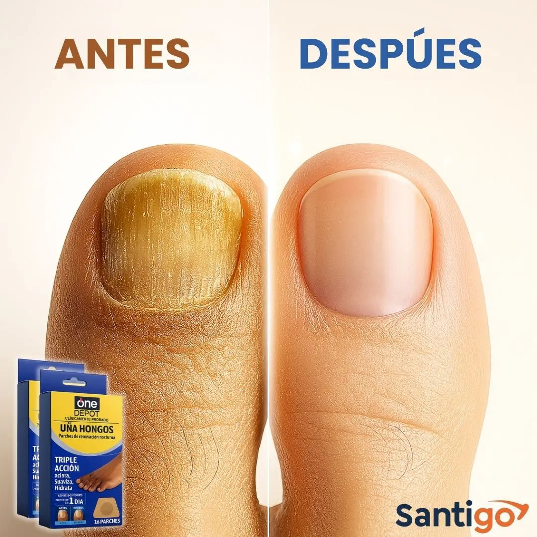 Parches Antihongos para Uñas – Mejora Visiblemente la Apariencia de tus Uñas Mientras Duermes – Tratamiento Fácil, Limpio y Efectivo | 2x1